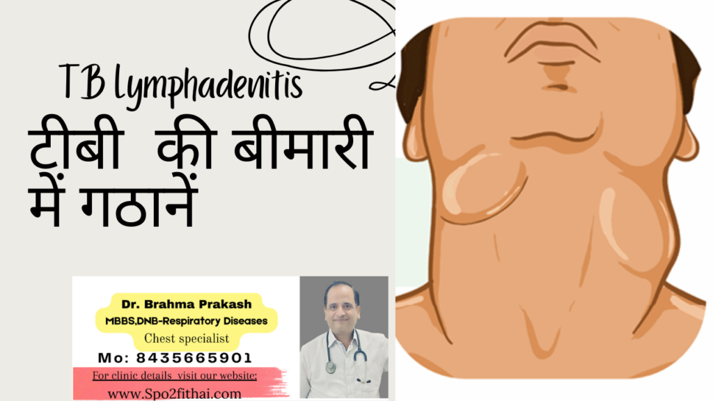 टी.बी.रोग की गठाने