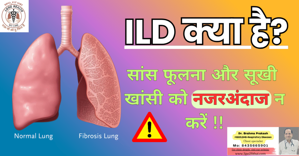 ILD-Interstitial Lung diseases